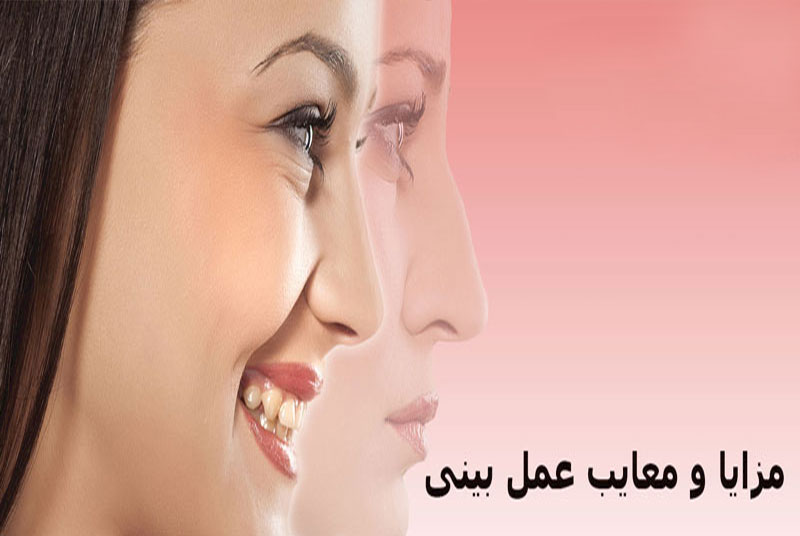 مزایا و معایب جراحی زیبایی بینی